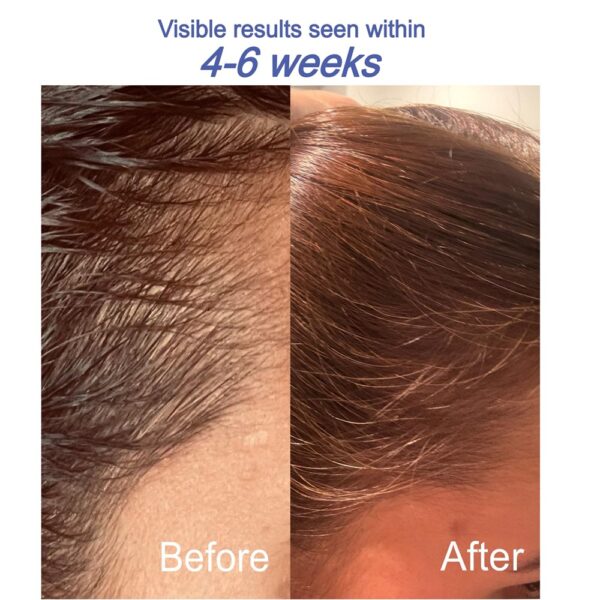 Hair Renewal Oil - Image 2