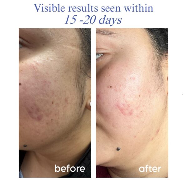 ScarVanish Serum - Image 5